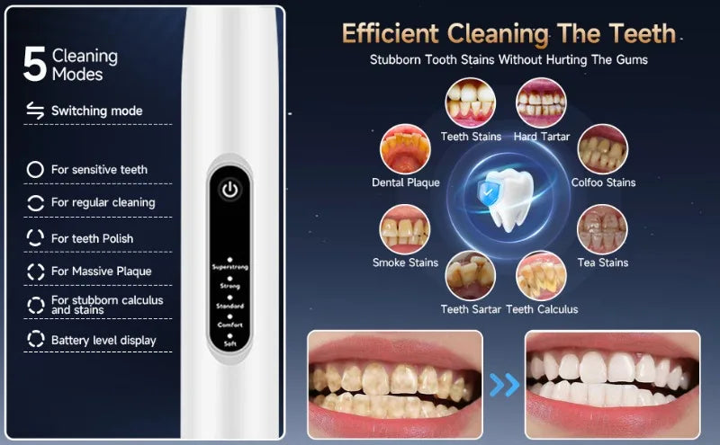Ultrasonic Dog Dental Cleaner Electric Toothbrush Cleanning Dog Teeth Plaque Remover Pet Dental Calculus Beauty  Instrument