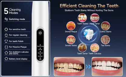 Ultrasonic Dog Dental Cleaner Electric Toothbrush Cleanning Dog Teeth Plaque Remover Pet Dental Calculus Beauty  Instrument