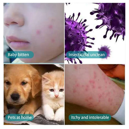 the NO FLEA SPRAY - 100ml Pet Expel Fleas Lice Treatments Spray, Quick and Handy Fleas Ticks Expellant for Dogs/Cats, Pet Health Supplies